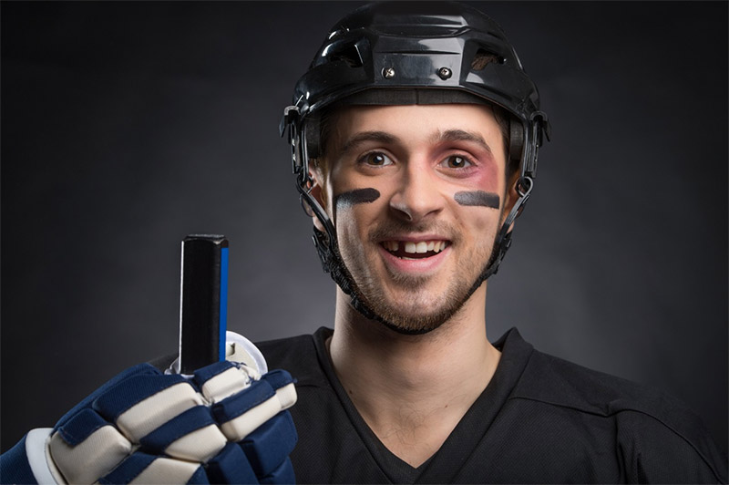sports dentistry patient in Calgary